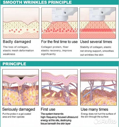 Липосоникс liposonix