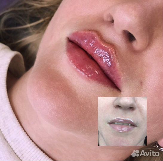 Обучение косметологов