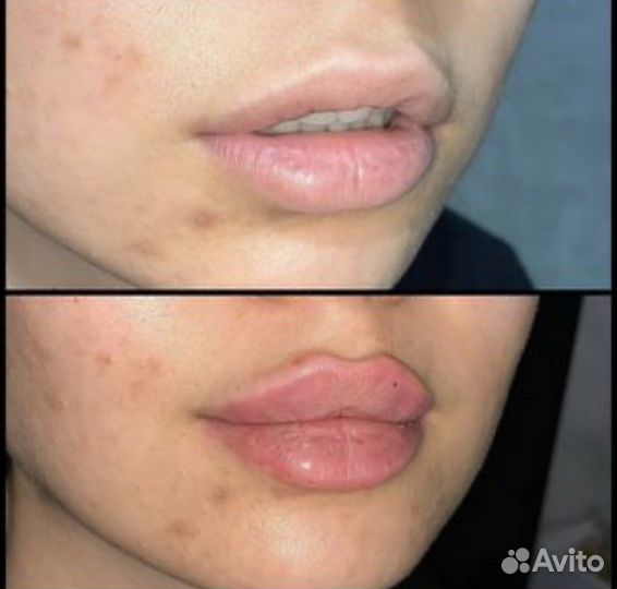 Врач косметолог