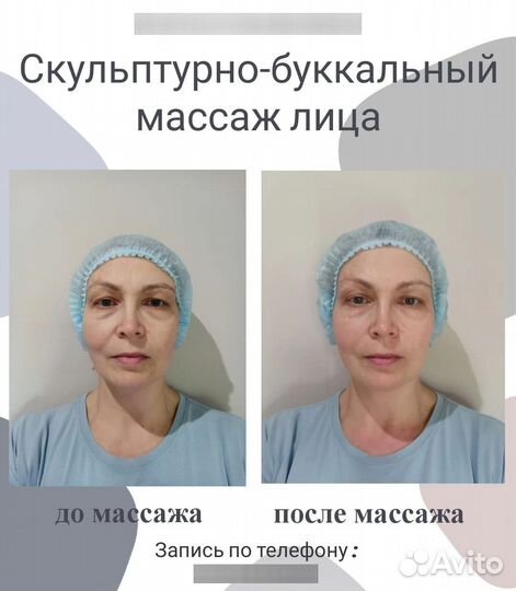 Скульптурно-буккальный массаж лица