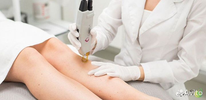 Готовый бизнес в сфере лазерной эпиляции