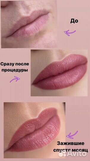 Перманентный макияж Татуаж Лазерное удаление