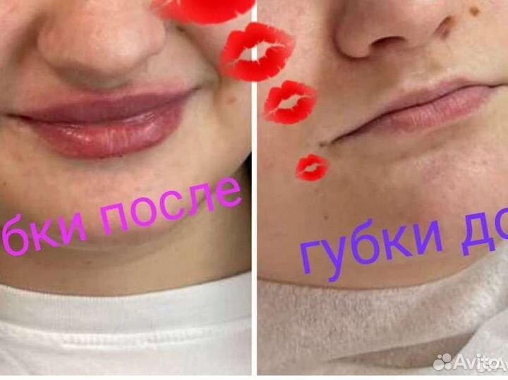 Косметолог пирсинг