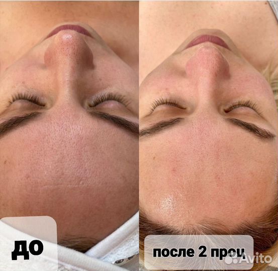 Услуги косметолога