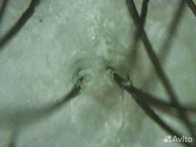 Пилинг кожи головы