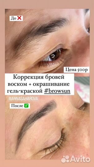 Косметолог чистка лица