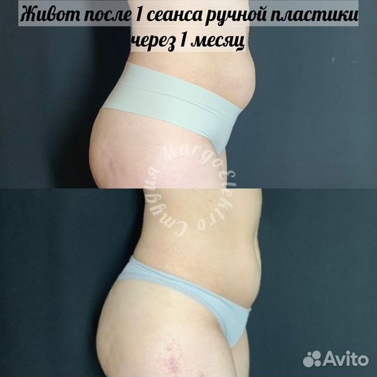 Ручная пластика тела, коррекция фигуры