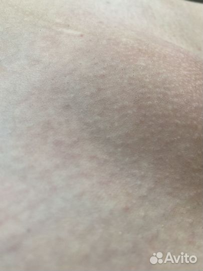 Электроэпиляция, шугаринг, воск