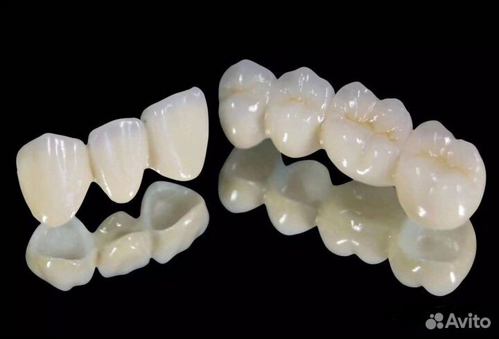 Изготовление зубных протезов