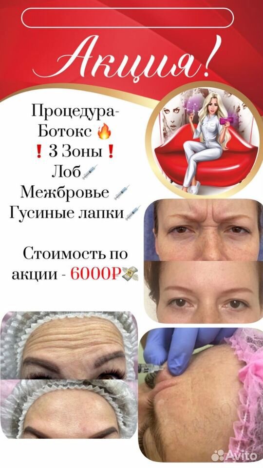 Ботокс для лица