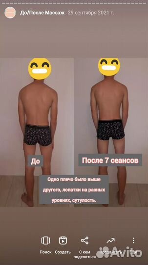 Антицеллюлитный массаж, миофасциальный массаж тела