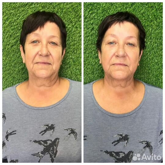 Массаж лица