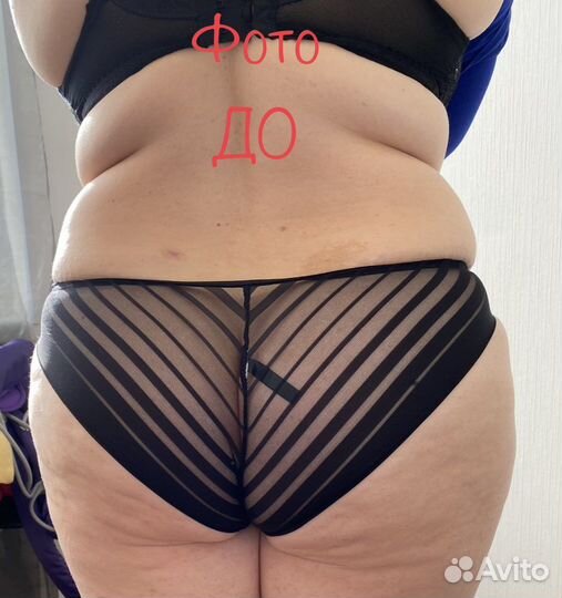 Аппаратный массаж/пресс/кавитация/RF/вибро