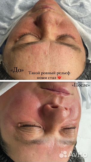 Услуги косметолога