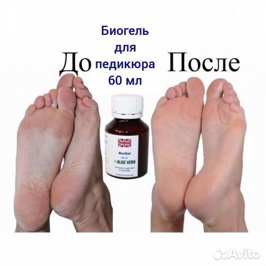 Биогель для проблемных пяток