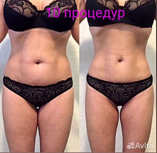 Массаж лица и тела. Коррекция фигуры