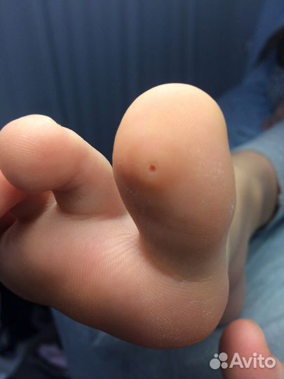 Медицинский аппаратный педикюр