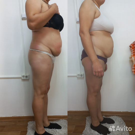 Антицеллюлитный массаж коррекция фигуры