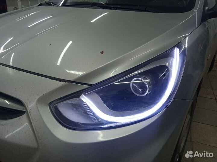 Фары Hyundai Solaris