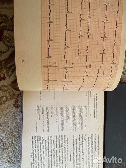 Атлас по электрокардиографии