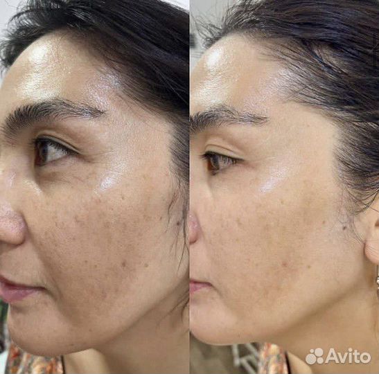 Косметологические услуги