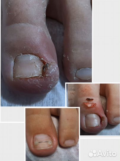 Подолог-педикюр