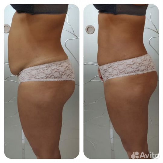 Массаж, который всегда работает