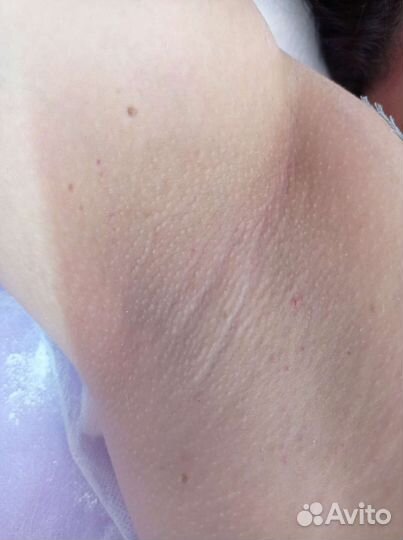 Шугаринг женский