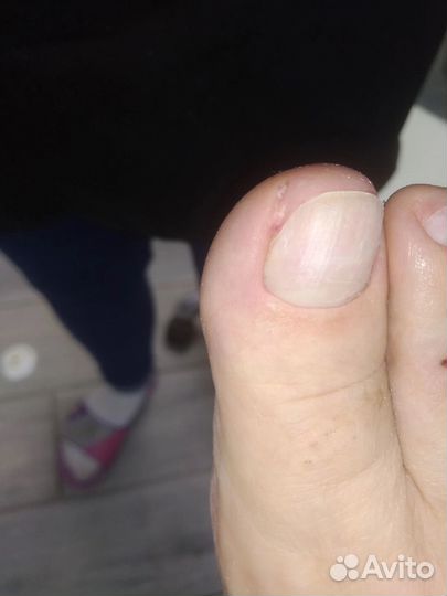 Маникюр педикюр наращивание ногтей