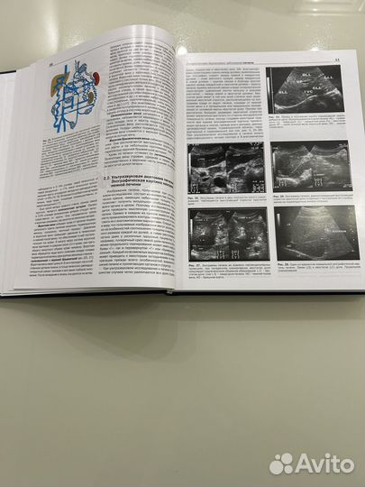 Практическое руководство по УЗ диагностике