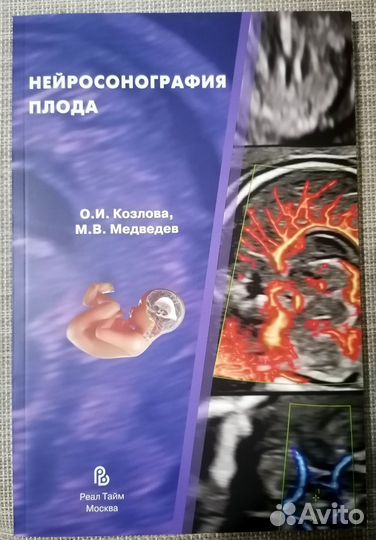 Нейросонография плода. М.В.Медведев О.И.Козлова