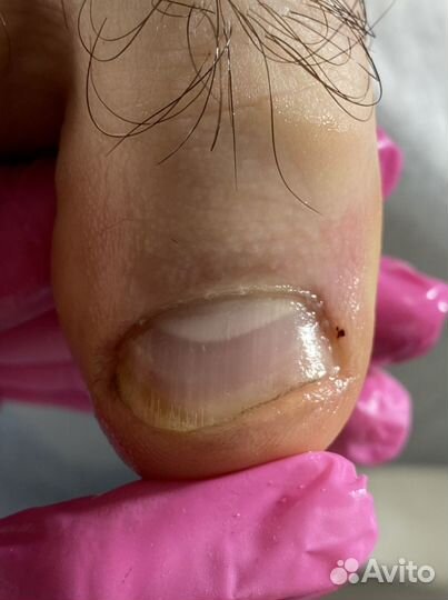 Подолог самара