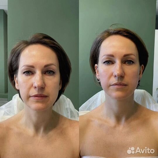 Массаж лица