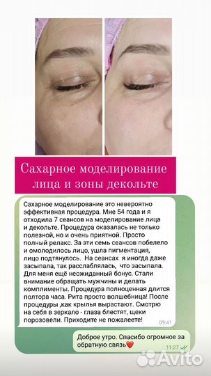 Подтяжка лица Сахарный Лифтинг Шугаринг