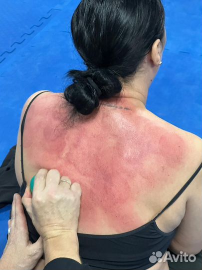 Юмейхо массаж, Сибирский казачий массаж, удм