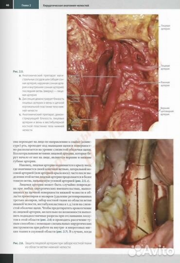 Хирургическая стоматология Маттео Кьяпаско