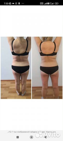 Вакуумный массаж